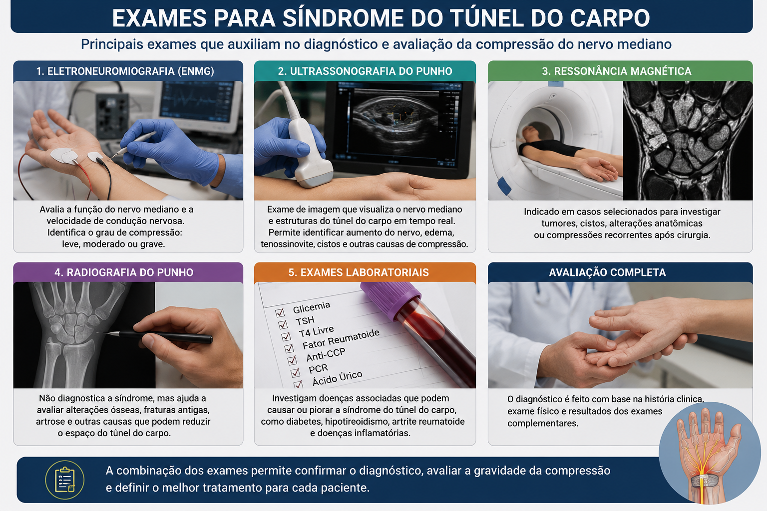 Exames para túnel do carpo