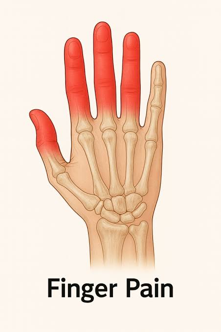 finger entorse