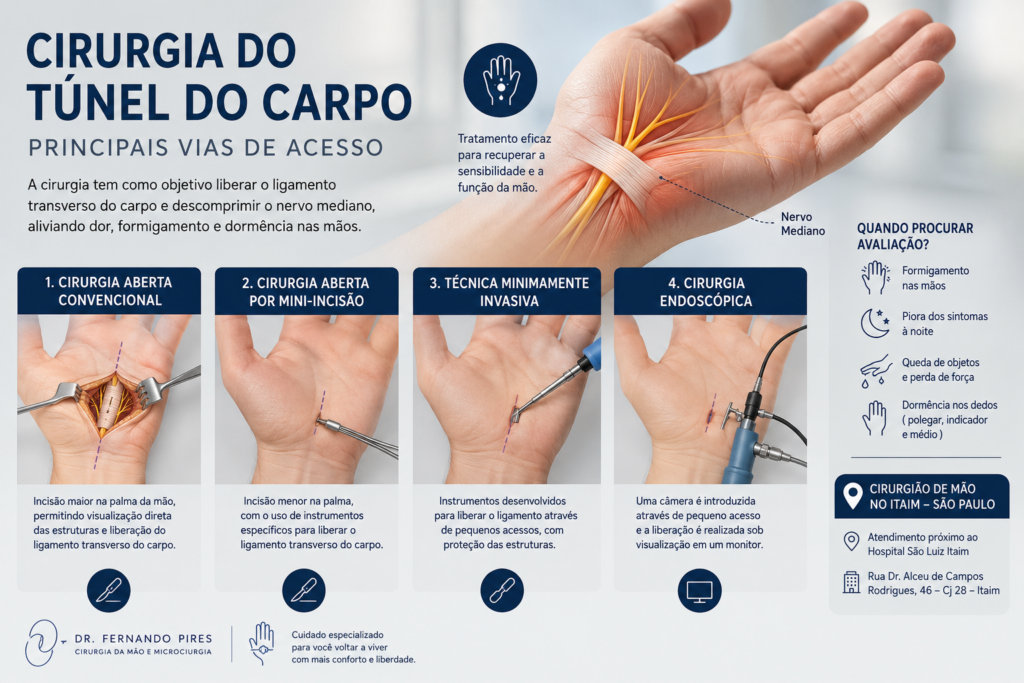 tipos de cirurgia do túnel do carpo